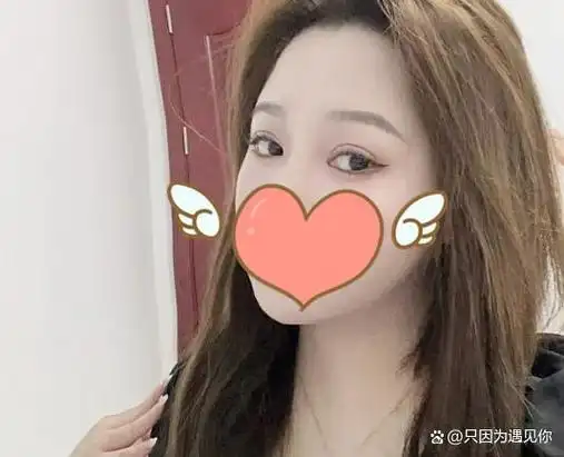 开扇形双眼皮也被称之为桃花眼,一直是我想要的眼型,为了拥有这么好看