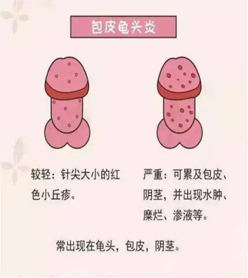 龟头有裂痕还有红点医药保养哪家好阜新康健泌尿外科医院