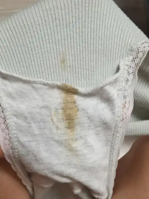 有没有宝妈13周白带颜色偏黄,偶尔流出黄色的奶状分泌物,无异味,不痒