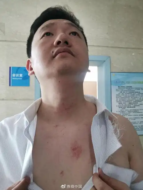 5月28日,皖通科技股东代表何振湘展示胸口伤痕.