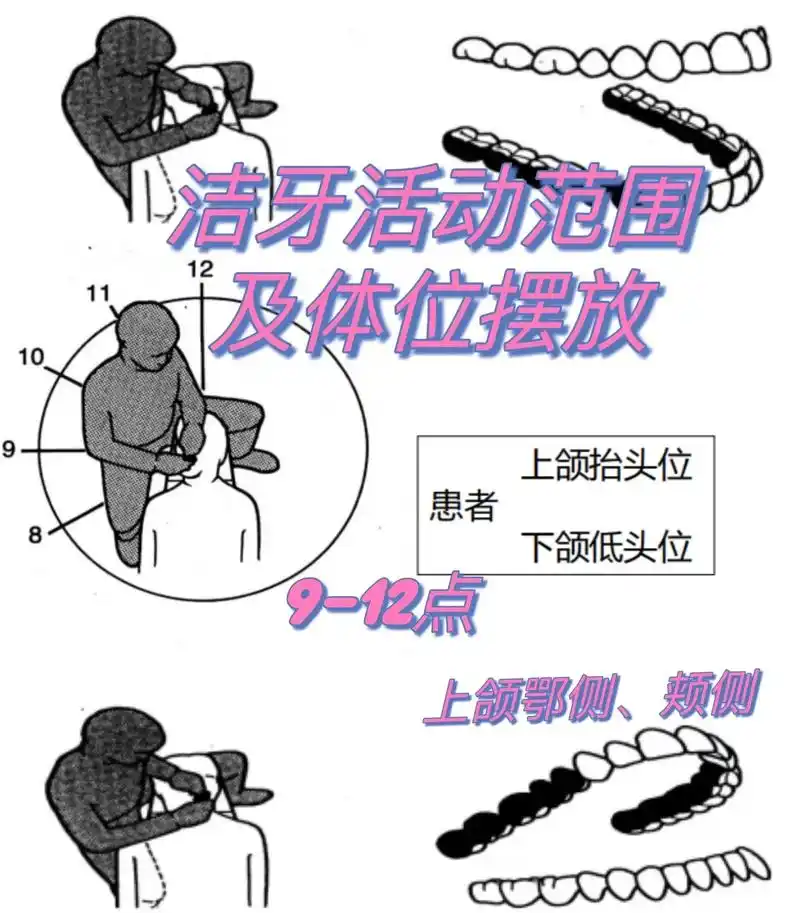 口腔操作流程第25弹 洁牙体位摆放