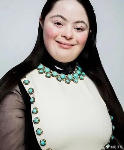 一个患有唐氏综合症的18岁英国女孩_高清图集_新浪网