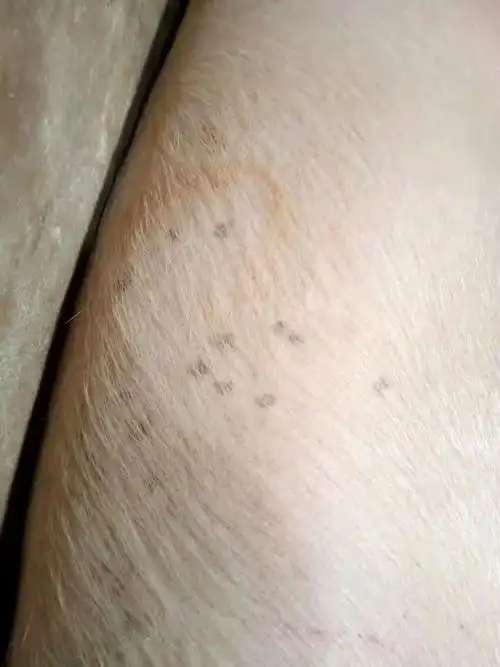 肚子上有了黑点是什么原因