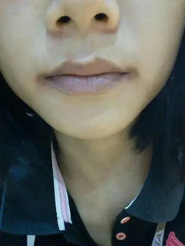 月经不调和嘴角发黑有关系吗?