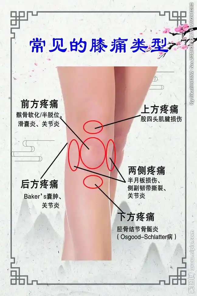 膝关节疼痛位置图 - 抖音