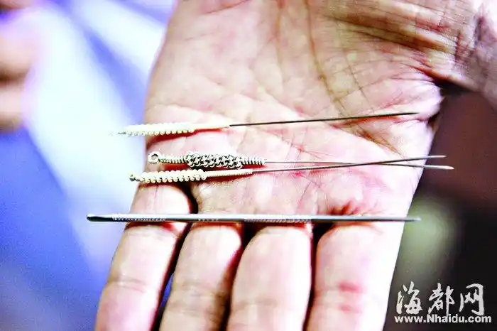 福州:女童昏迷90天 "小儿飞针"救回来