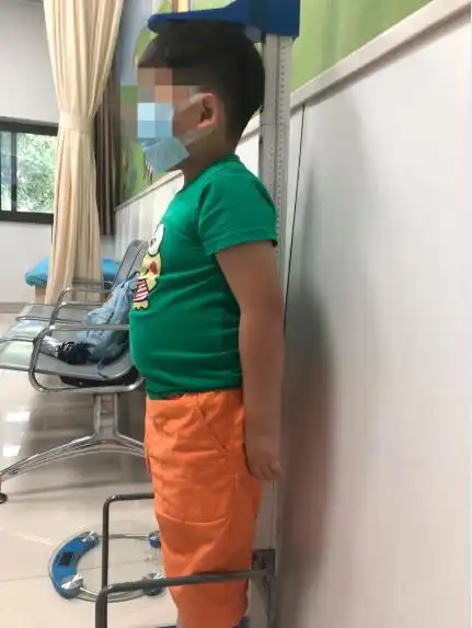 200斤重的13岁男孩因肥胖引发并发症…发育门诊,10人中有1人肥胖