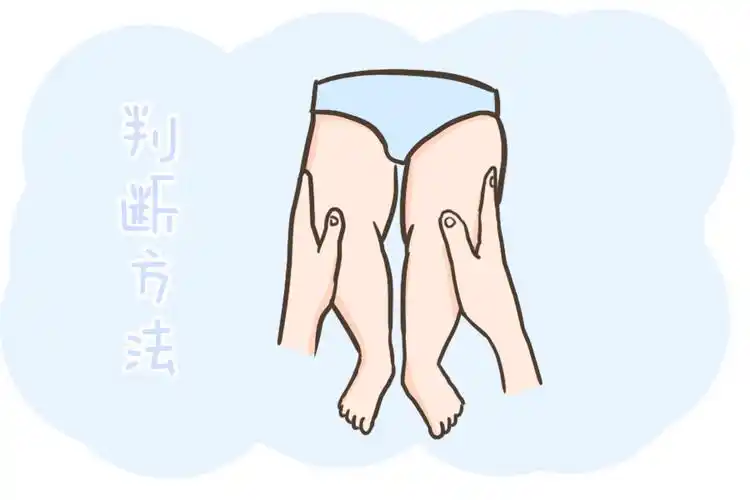 原创家长提问:四个月大的婴儿髋关节发育不良会对小孩有什么影响?