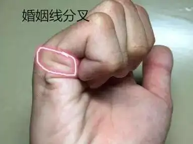 1,婚姻线分叉花钱多数是大手大脚的,能同福不能共