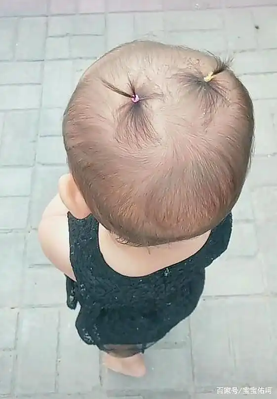 为什么有的宝宝头发稀少,有的宝宝头发很浓密?主要取决于这两点