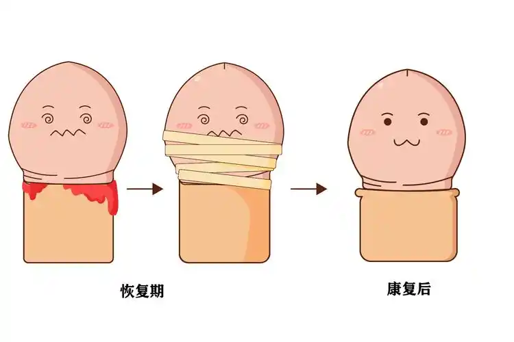 包茎手术后的图片