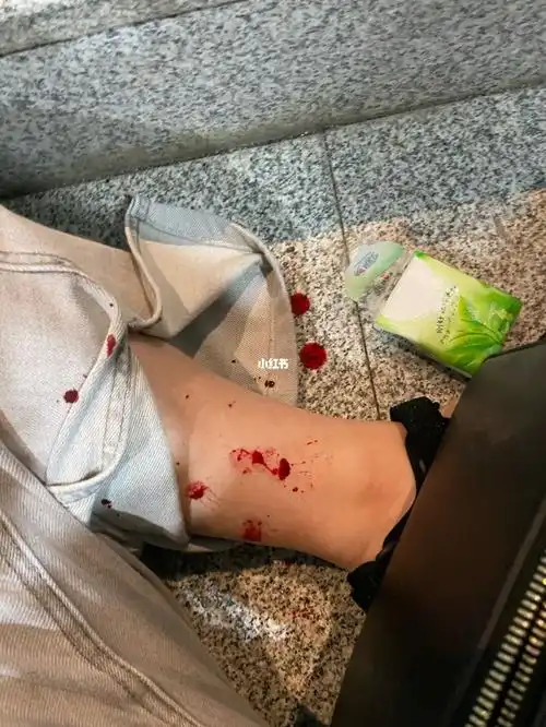 35岁高龄在动车站出站下楼梯时摔了一跤_意外_生活记录_接地气生活