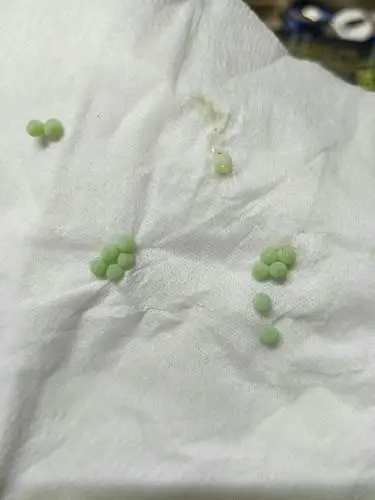 这是什么东西啊,衣服上突然发现这个