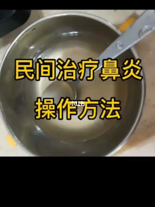 民间治疗鼻炎操作方法