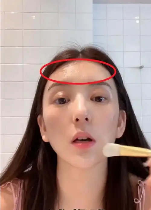 方媛直播额头皮肤坑坑洼洼状态差显老态网友质疑是整容后遗症