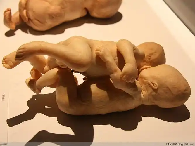 科普组图:完整人体解剖图 原来我们的身体是这样的!