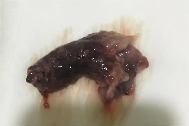 42天左右药流孕囊图