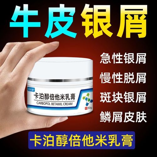 牛皮癣专用药膏银屑病进口外用日光性皮炎组合全身止痒膏皮肤瘙痒