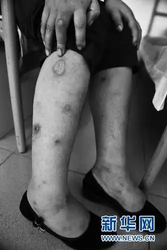 毒品,让她们的青春褪色