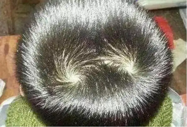 有牛头旋的人命运如何?