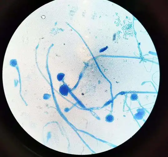 真菌大讲堂拾零(七)曲霉篇