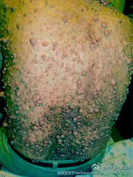 芝麻手的恶心图片