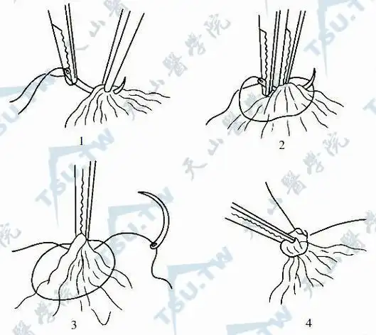 皮肤外科手术操作基础langer线运刀剥离止血缝合