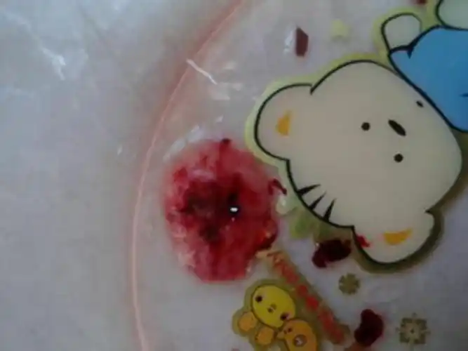 早孕药流排出的孕囊形状图片