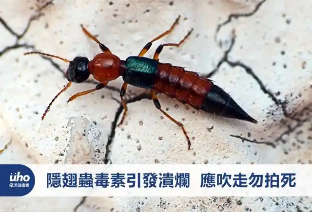 隐翅虫毒素引发溃烂 应吹走勿拍死