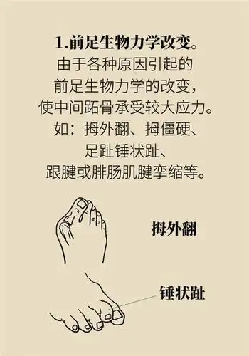 当心这可能是跖痛症