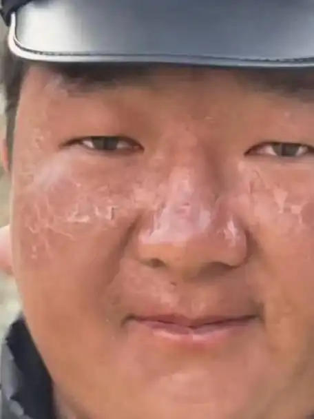高原警察无惧风吹日晒坚守一线脸颊的痕迹让人心疼