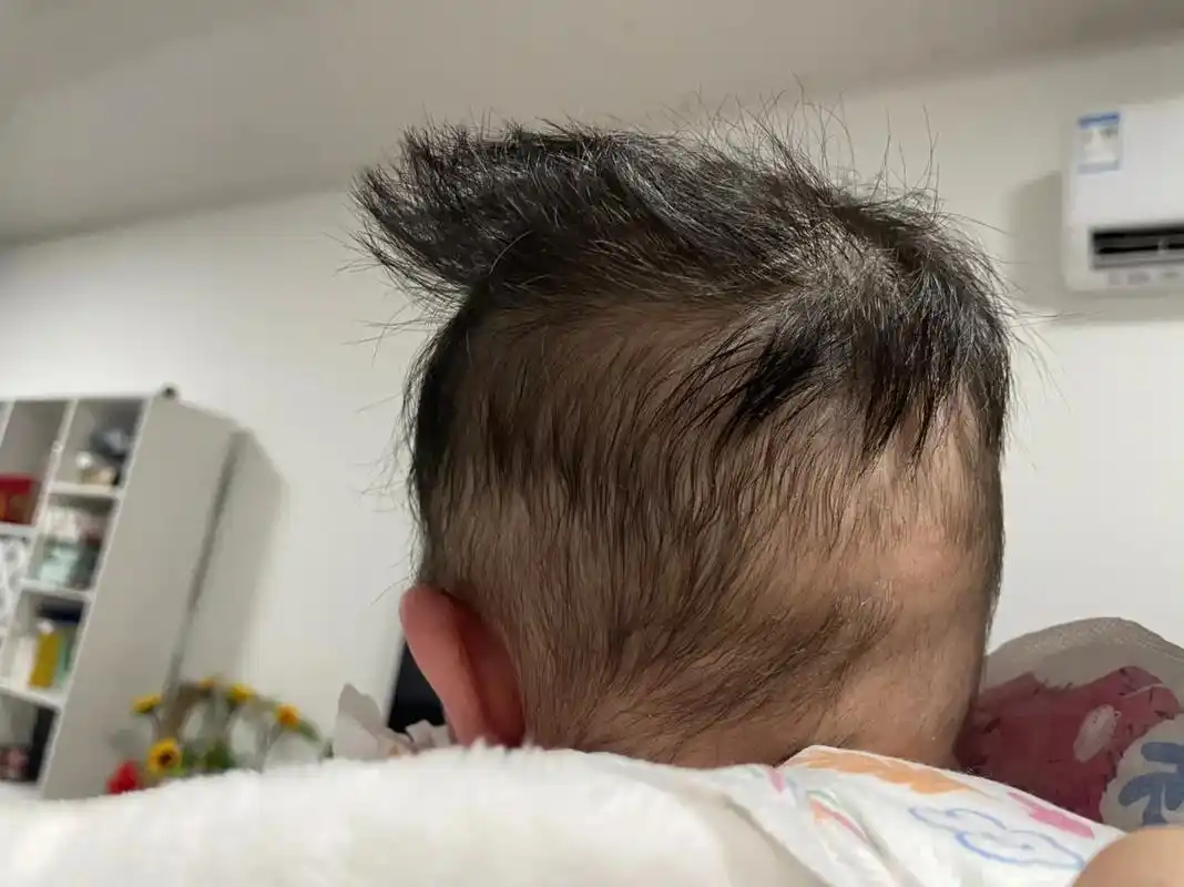 完啦 完啦 大平头儿子96.睿儿呀 你的后脑勺是离家出走了嘛 - 抖音