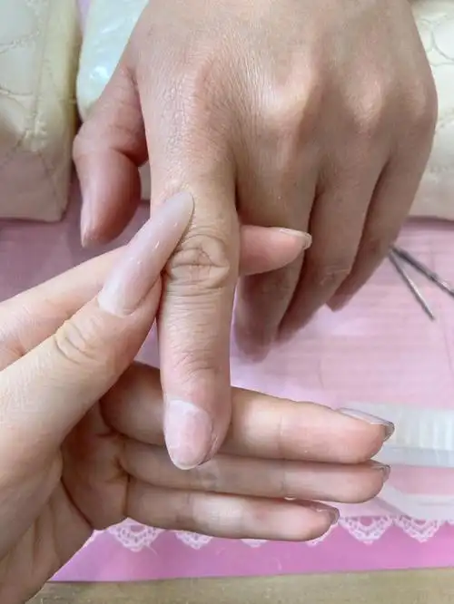 第一次见这么歪的指甲盖