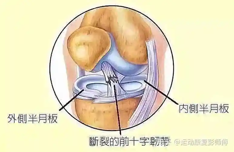打球膝盖真的那么脆弱吗,像艾弗森那种高爆发打法会不会伤病?
