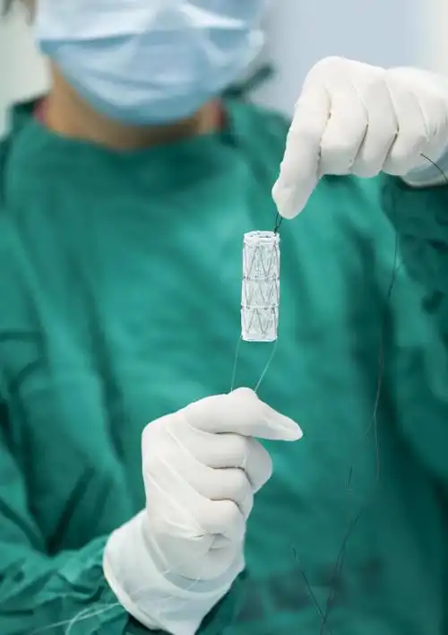 大医之术79我院完成支气管镜z型覆膜粒子支架植入术