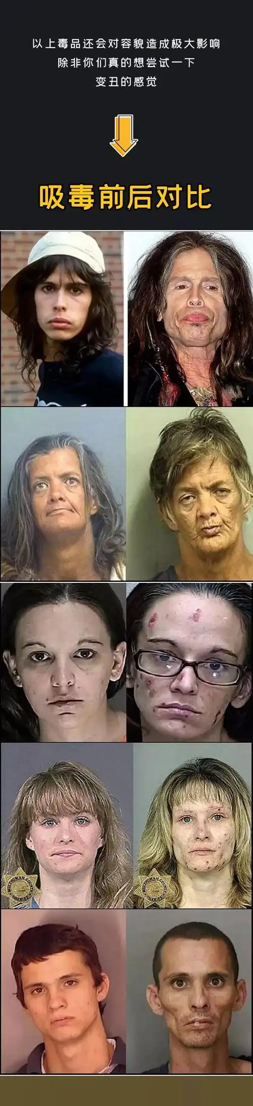 【热点关注】吸毒真的会变丑!一波辣眼睛照片流出
