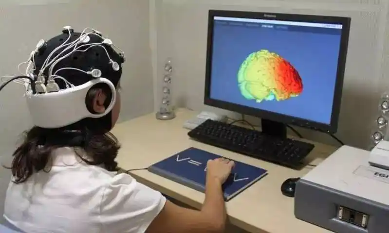 电刺激会让"脑洞大开"