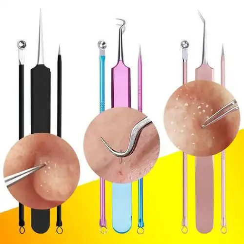 挤出来的是白色的液体分泌物,就是皮脂的分泌物,是脂肪酸.