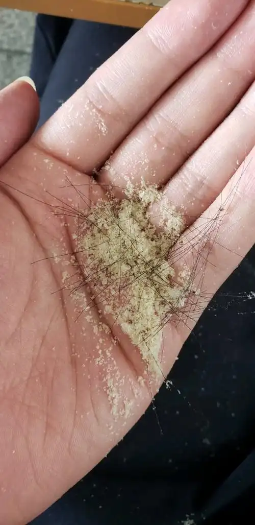 大块大块地掉头皮屑,有什么好用的男士去屑洗发水推荐? - 知乎