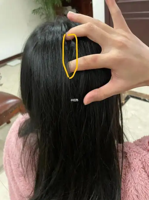 头顶有个坑手指的地方一按就疼