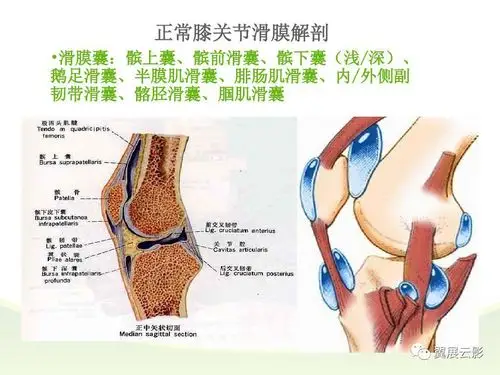 膝关节滑膜病变mri表现
