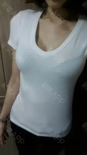 我来更新日志了,现在我在da整形做完水滴隆胸已经49天啦.