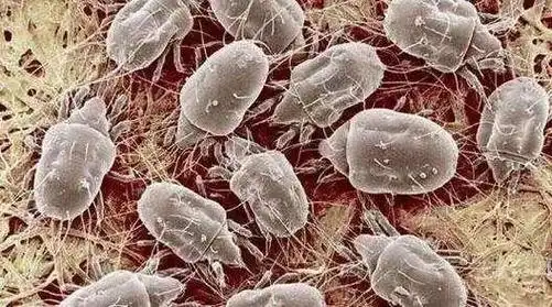 如何去除床上的螨虫怎么判断床上有螨虫