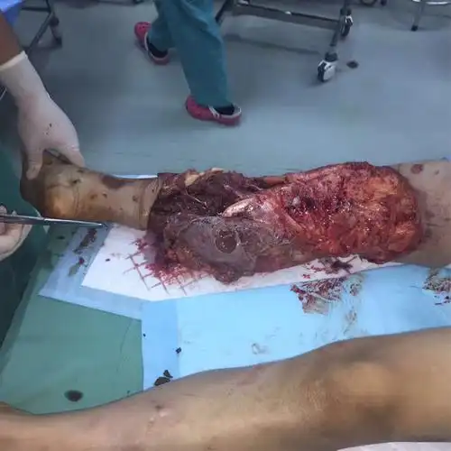 不要轻言放弃(一)