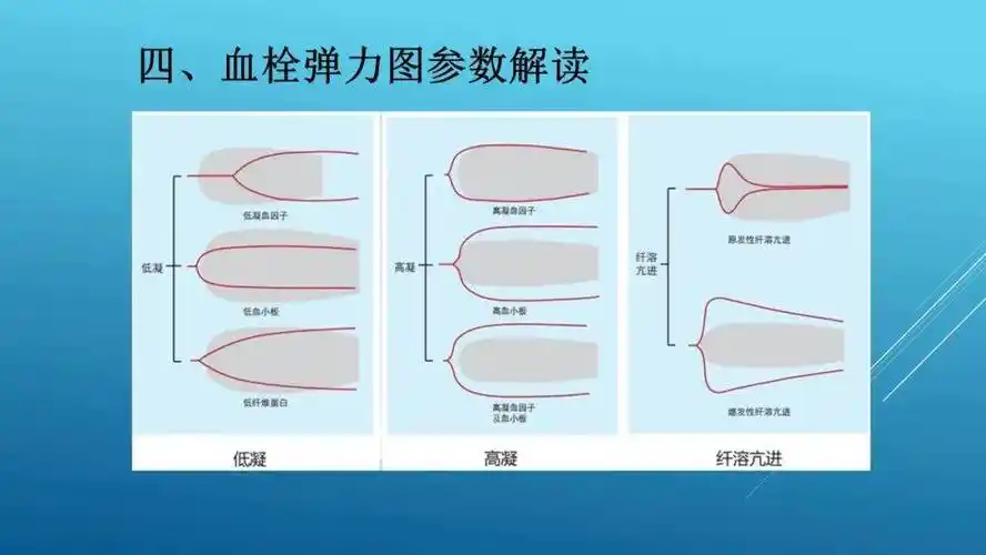 6月阅读:血栓弹力图的介绍与应用_异议_立场_网站