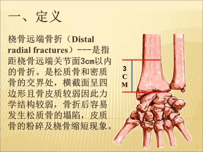桡骨远端骨折教学查房