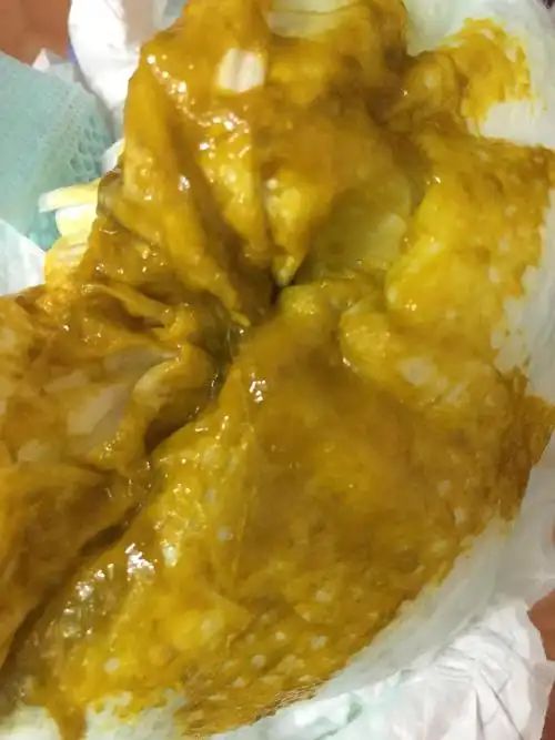 全母乳喂养的宝宝,啦的粑粑是这样的正常吗?