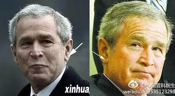 易博娱乐:【快抢,第六波红包来了】医生忘了告诉