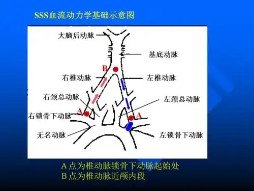 锁骨下动脉窃血综合征ppt