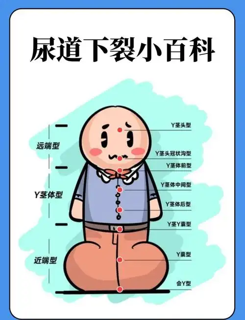 👦尿道下裂:男性健康的隐形杀手